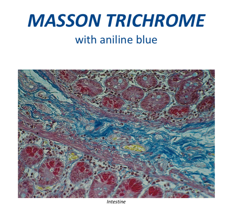 Masson Trichrome 100 ტესტი 0